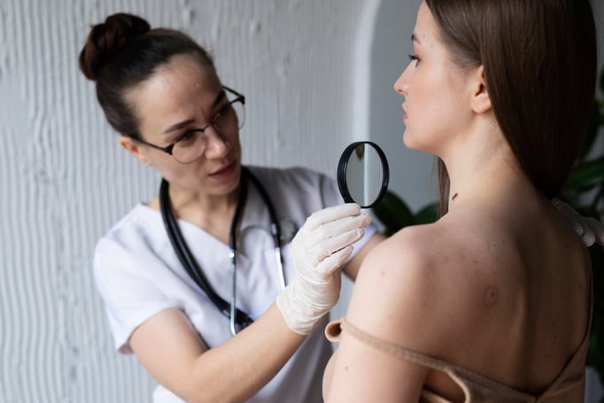 Prevencion cancer de piel médico